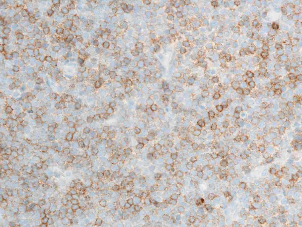 Lymph node 2010 CD4 40X